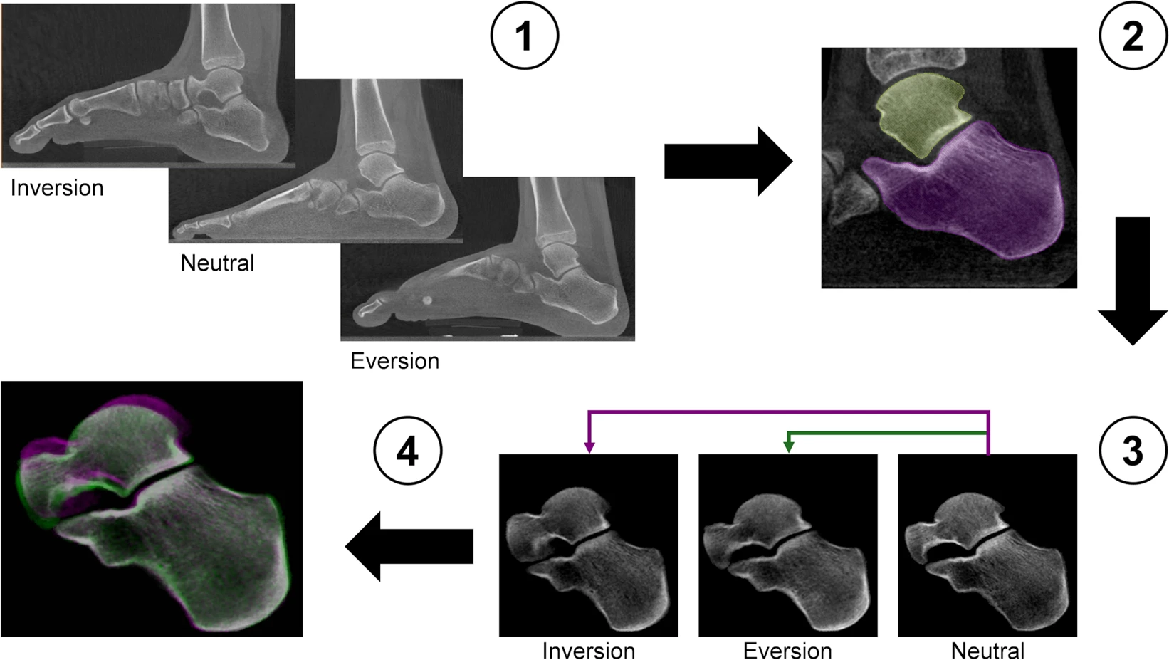 Workflow of the image post-processing