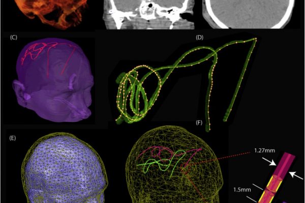 1-s2.0-S105381191830819X-gr2