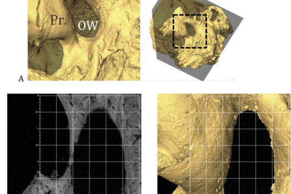 3D reconstruction from micro-ct data of the middle ear cavity of SK 879