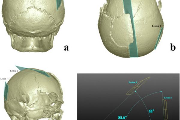 1-s2.0-S2352409X17306363-gr5