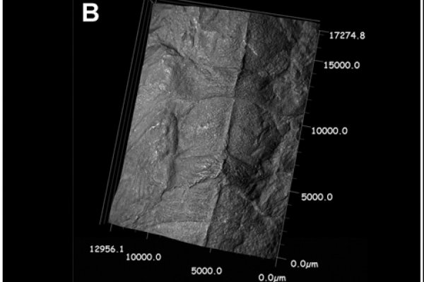 3D-reconstruction-of-thoracic-alinota