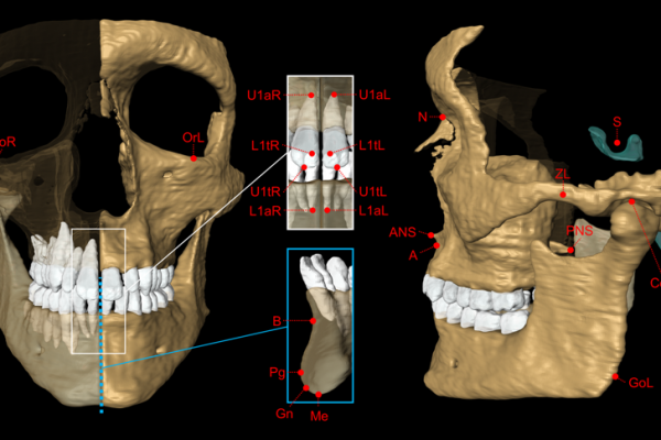 41598_2018_31384_Fig4_HTML