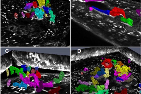 Application of Nuclear Volume Measurements