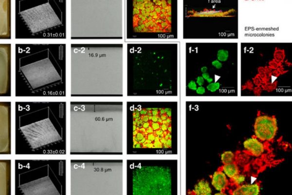 AmiraSoftware_ThermoScientific_Biofilm three-dimensional architecture