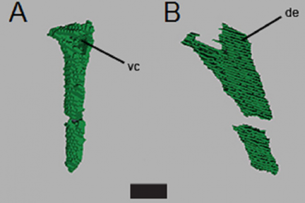CT segmentation of left ulna
