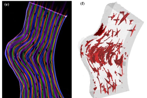 Carbon-fibers-reinforced-polymer