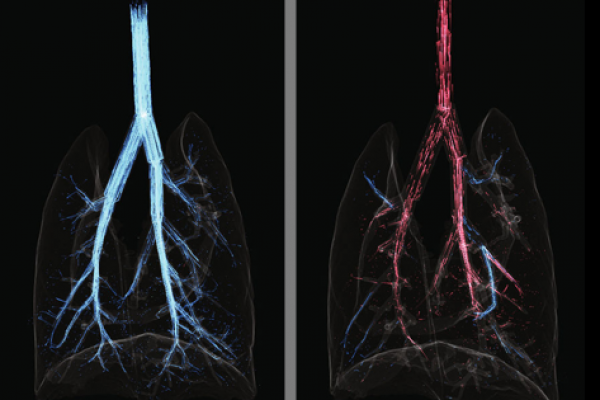Cardiogenic-Airflow-in-the-Lung