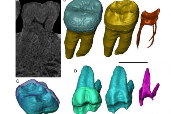 Dental-fossil-remains