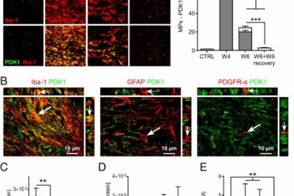 Hyperpolarized 13C MR metabolic imaging can detect neuroinflammation _amira-software