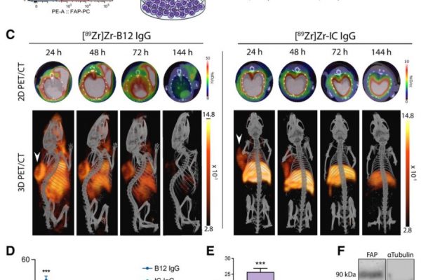 Imaging Fibroblast Activation Protein Alpha Improves Diagnosis of Metastatic Prostate Cancer with Positron Emission Tomography