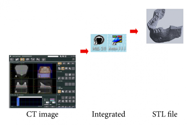 amira-software Influence of Deformation and Stress between Bone and Implant from Various Bite Forces by Numerical Simulation Analysis