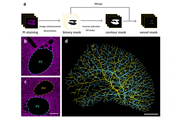 Multiscale reconstruction of various vessels in the