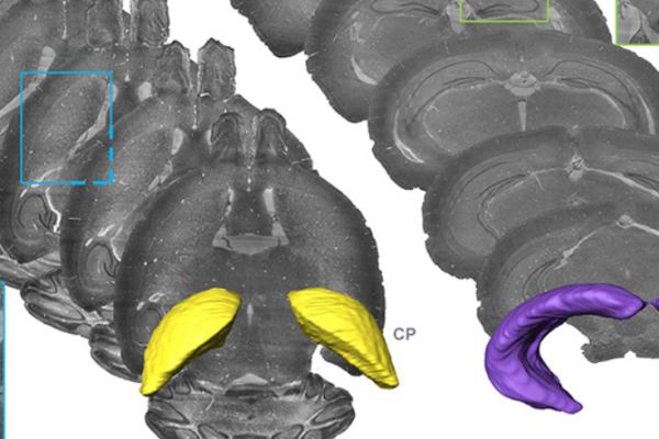 amira-software Precise Cerebral Vascular Atlas in Stereotaxic Coordinates of Whole Mouse Brain