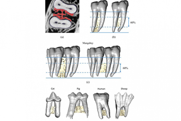 Segmentation of RTT and RST VOIs