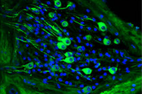 Spiral-ganglion-neurons