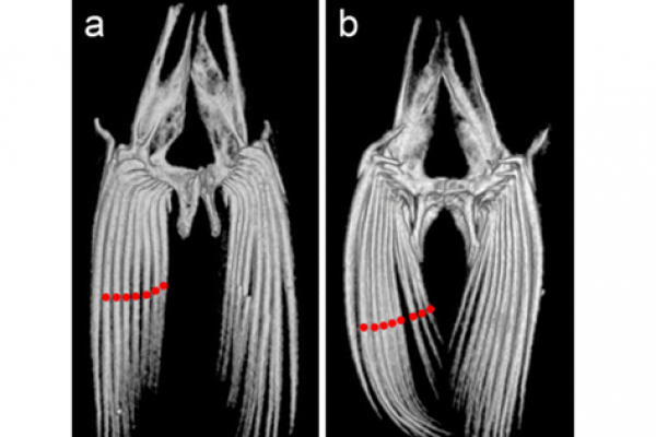 Variations of pelvic fin ray numbers
