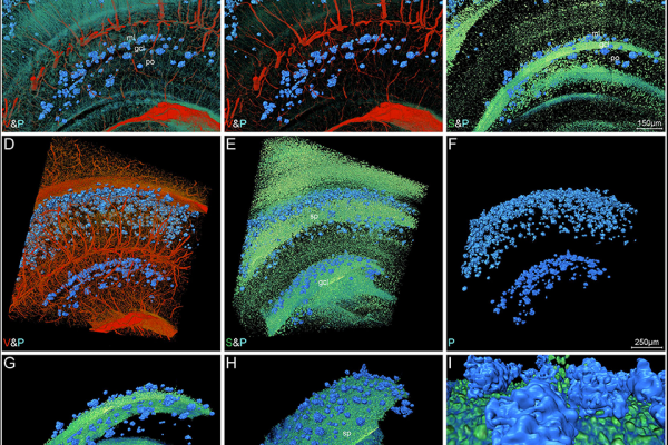 Visual reconstruction of Aβ plaques and adjacent somata and vessels in hippocampal area