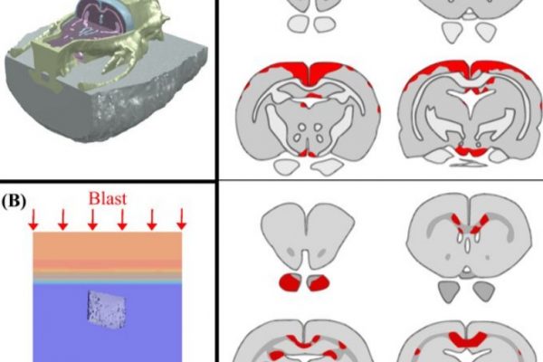 amira-software-Cognition based bTBI mechanistic criteria; a tool for preventive and therapeutic innovations