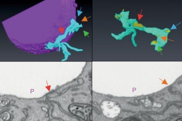 amira-software-STIM1-promotes-migration-phagosomal-maturation-antigen-cross-presentation-in-dendritic-cells