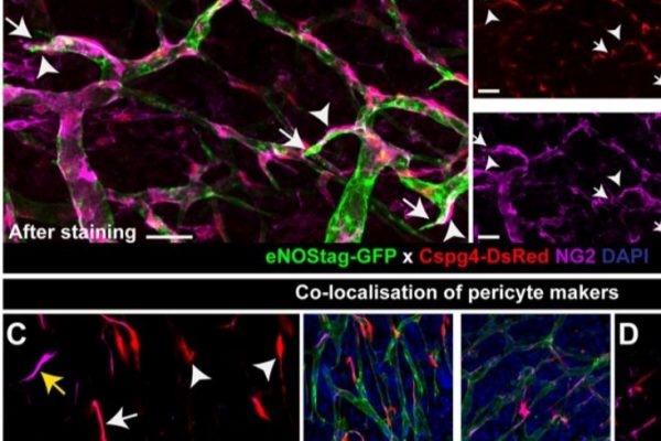 amira-software-Spatiotemporal endothelial cell – pericyte association in tumors as shown by high resolution 4D intravital imaging