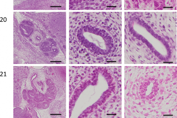 journal.pone.0203623.g003