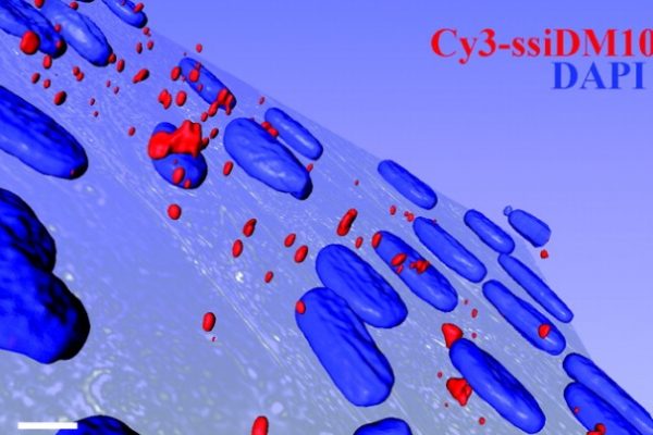 paper_amira_Cytoplasmic and Nuclear Retained DMPK mRNAs Are Targets for RNA Interference in Myotonic Dystrophy Cells