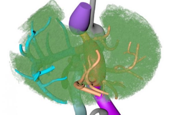 paper_amira_Human liver segments role of cryptic liver lobes and vascular physiology in the development of liver veins and left-right asymmetry