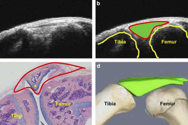 paper_amira_Utilization of longitudinal ultrasound to quantify joint soft-tissue changes in a mouse model of posttraumatic osteoarthritis