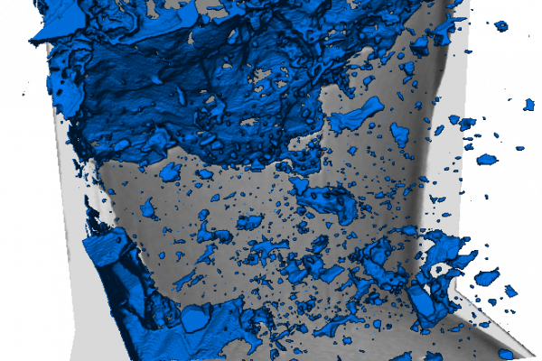 pore-back-segmentation