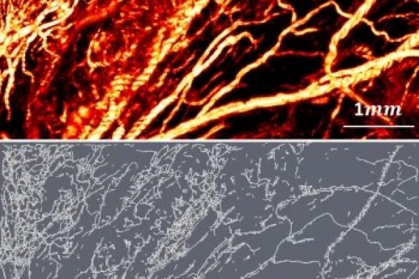 skeletonized vasculature ovary and fallopian tube