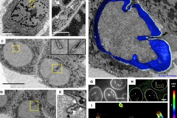 thermoscientific-amirasoftware_Deep nuclear invaginations