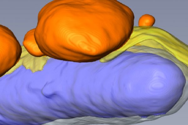 thermoscientific-amirasoftware_Macropinosomes are key players