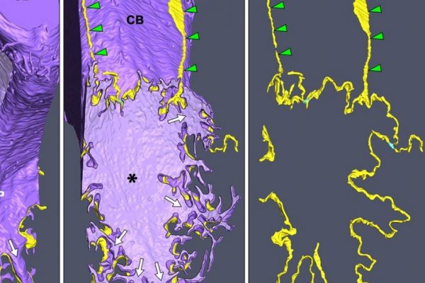 thermoscientific-amirasoftware_Morphological process of podocyte
